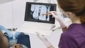 Dental X-Ray