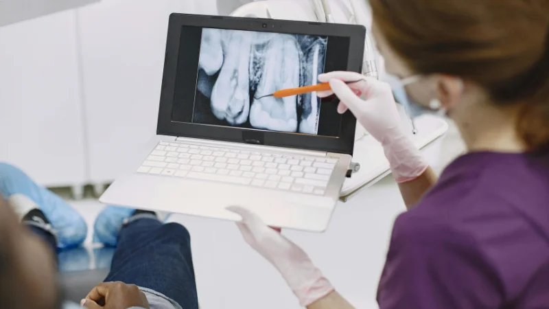 Dental X-Ray