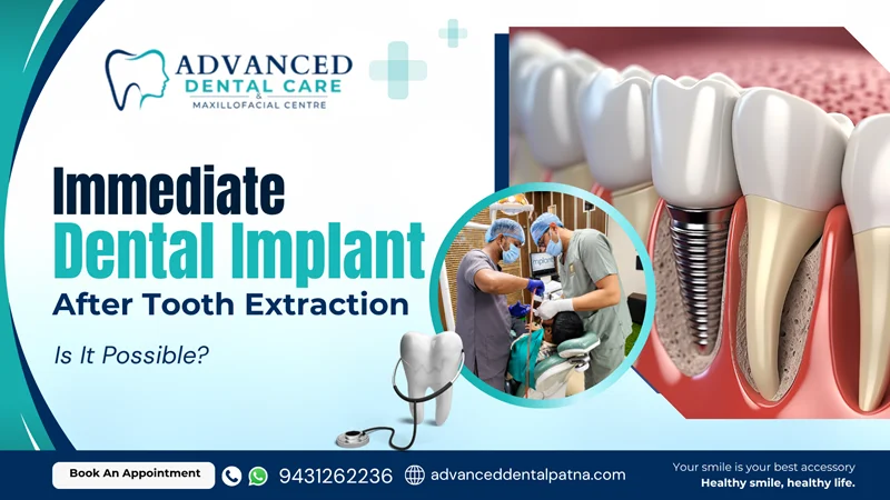 Dental Implant After Tooth Extraction